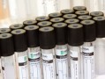 柑橘病蟲害全年防治用藥技術要點與科學管理指南