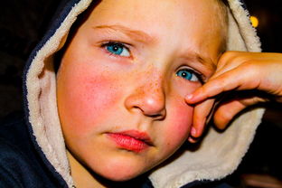 糖尿病可不可以吃金桔(糖尿病的人可以吃金桔嗎)