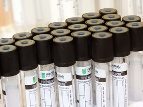 柑橘新品種如何研發(fā)：關(guān)鍵科學(xué)方法與技術(shù)路徑全解析